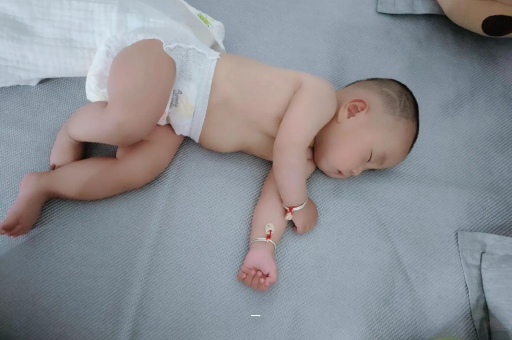 海门宝宝脸上有白色斑块